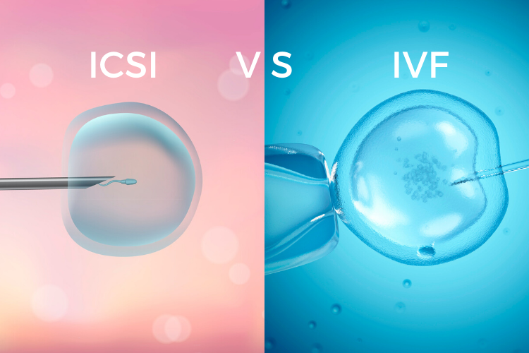 ICSI Versus IVF